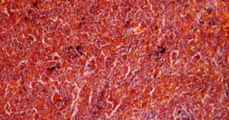 과학 이동 세포 사람없음 빨간색 파란색 약 시험 성장 조직 확대 질병 지라 지원 4K 현미경관찰 MOV 해외동영상 클립영상 교육 컬러 컨셉 의학 관찰 동영상 파일형식