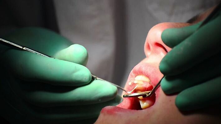 백인 직업 여자 산업 어린이 건강 치과 병원 사람 치료 약 장비 환자 의사 기구 오픈 입 닫기 치아 무서움 부식 치과의사 방문 순서 돌봄 명패 송곳 위생관리 잇몸 HD 구강학 MOV 해외동영상 클립영상 서양인 감정 신체 의학 모션 관리 신체부위 의료진 소화기관 동영상 파일형식