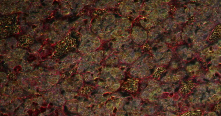 과학 이동 패턴 세포 사람없음 빨간색 파란색 약 시험 성장 조직 확대 지원 4K 현미경관찰 MOV 해외동영상 클립영상 교육 컬러 컨셉 무늬 의학 관찰 동영상 파일형식