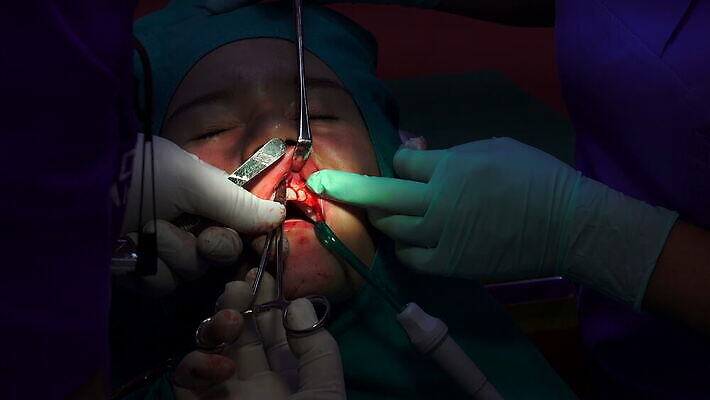 직업 남자 부분 건강 치과 병원 사람 치료 약 방 환자 의사 도구 긴급 입 구멍 수술 닫기 치아 상처 플라스틱 사건 치과의사 뿌리 운하 외과 돌봄 바늘땀 위생관리 잇몸 작동 살균 실종 4K MOV 해외동영상 클립영상 신체 의학 모션 재질 관리 신체부위 의료진 소화기관 동영상 파일형식