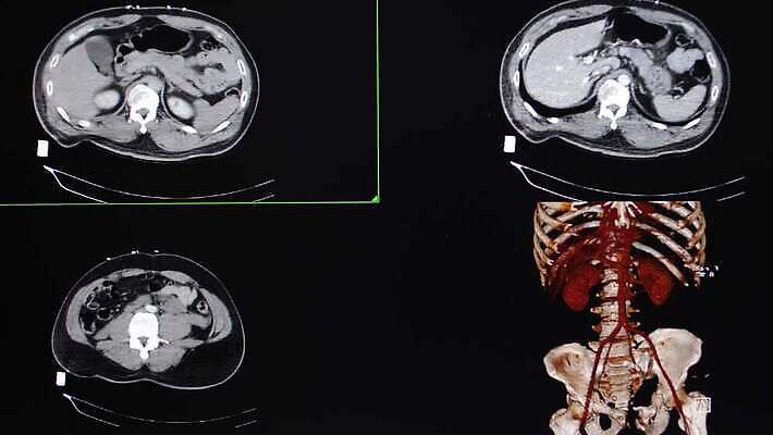 과학 신체 해부 모션 뼈 엑스레이 건강 사람없음 내부 컴퓨터 약 시험 환자 광선 혈액 X 필름 간 몸통 골절 방사선 스캔 지라 4K MP4 해외동영상 클립영상 알파벳 교육 의학 신체부위 전자제품 장기_의학 동영상 파일형식