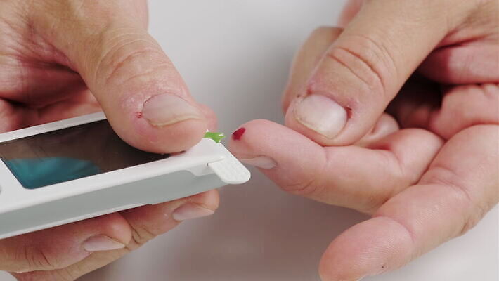 백인 손 컨셉 신체 손가락 건강 사람 치료 약 건강관리 모니터 고통 장비 환자 흰색 기구 막대기 혈액 떨어짐 질병 설탕 피부 분석 측정 확인 계량기 당뇨병 돌봄 인슐린 제어 포도당 4K MOV 해외동영상 클립영상 서양인 감정 컬러 의학 모션 관리 신체부위 컴퓨터 동영상 파일형식