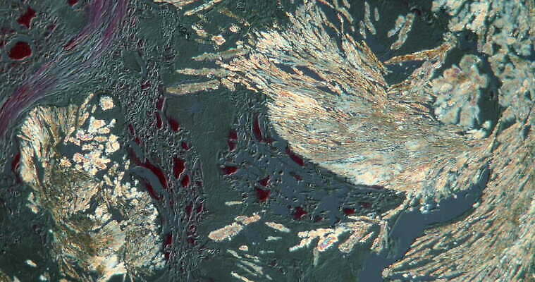 과학 이동 패턴 세포 사람없음 빨간색 파란색 약 고통 시험 성장 조직 확대 질병 입술 결정체 지원 4K 현미경관찰 MOV 해외동영상 클립영상 교육 감정 컬러 컨셉 무늬 의학 신체부위 관찰 동영상 파일형식