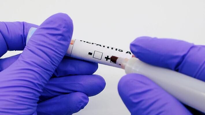 과학 실험 사람없음 치료 라벨 견본 건강관리 미국 중국 장비 의사 실험실 바이러스 결과 질병 컨테이너 수집 분석 시험관 긍정 감염 전염 튜브 박테리아 전염병 사스 코로나바이러스 4K 유체 MP4 해외동영상 클립영상 산업 아시아 컨셉 북아메리카 의학 프레임 건강 실험기구 관리 의료진 동영상 파일형식