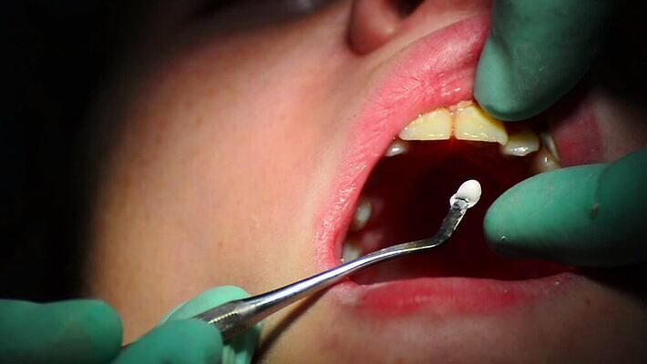 백인 직업 여자 산업 어린이 건강 치과 병원 사람 치료 약 장비 환자 의사 기구 오픈 입 닫기 치아 무서움 부식 치과의사 방문 순서 돌봄 명패 송곳 위생관리 잇몸 HD 구강학 MOV 해외동영상 클립영상 서양인 감정 신체 의학 모션 관리 신체부위 의료진 소화기관 동영상 파일형식