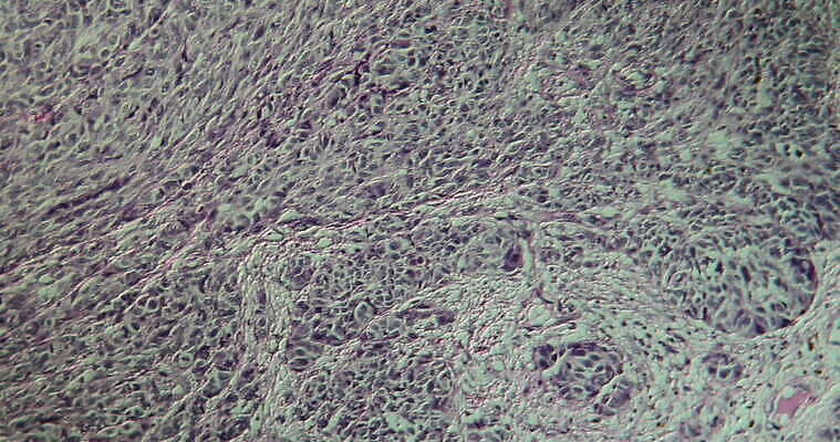 과학 이동 패턴 세포 사람없음 빨간색 파란색 약 시험 성장 조직 확대 질병 종양 지원 4K 현미경관찰 MOV 해외동영상 클립영상 교육 컬러 컨셉 무늬 의학 관찰 동영상 파일형식