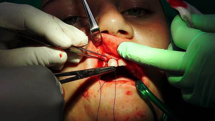 표면 건강 손잡이 약 반사 금속 잠김 의사 도구 입 수술 닫기 치아 오브젝트 치과의사 외과 순서 돌봄 바늘땀 보유 철강 살균 4K MP4 해외동영상 클립영상 의학 모션 재질 병원 신체부위 치료 의료진 소화기관 동영상 파일형식