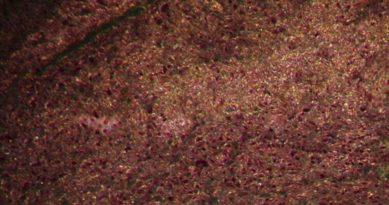 과학 이동 패턴 근육 세포 사람없음 빨간색 파란색 약 시험 성장 하트 조직 확대 질병 지원 흉터 4K 현미경관찰 MOV 해외동영상 클립영상 모양 교육 컬러 컨셉 무늬 의학 관찰 상처 동영상 파일형식