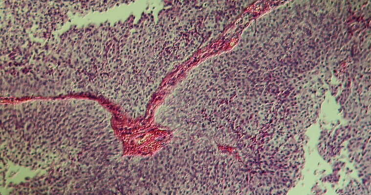 과학 이동 패턴 세포 사람없음 빨간색 파란색 약 시험 성장 조직 확대 질병 종양 지원 4K 현미경관찰 MOV 해외동영상 클립영상 교육 컬러 컨셉 무늬 의학 관찰 동영상 파일형식