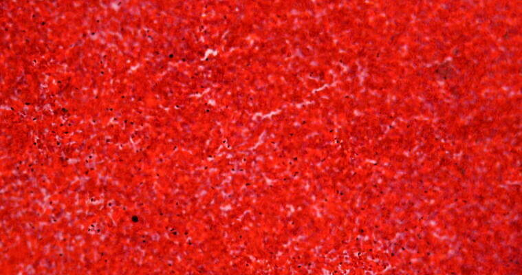 과학 이동 세포 사람없음 빨간색 약 시험 성장 조직 혈액 확대 쥐 부드러움 지원 4K 현미경관찰 MOV 해외동영상 클립영상 교육 컬러 컨셉 의학 관찰 감각 설치류 동영상 파일형식