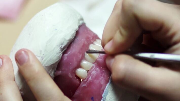 모델 직업 손 왕관 건강 치과 병원 실험 미소 치료 약 금속 기계 장비 흰색 공구 업무 도자기 입 기술자 실험실 치아 제조 묘사 치과의사 뿌리 외과 턱 틀니 돌봄 방법 보철 복원 위생관리 인공 치아교정 4K MP4 해외동영상 클립영상 컬러 의학 모션 재질 표정 관리 신체부위 의사 도구 작업 소화기관 교정 동영상 파일형식