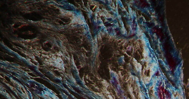 과학 패턴 세포 사람없음 빨간색 파란색 시험 성장 조직 질병 연골 지원 4K 현미경관찰 MOV 해외동영상 클립영상 교육 컬러 무늬 의학 관찰 동영상 파일형식