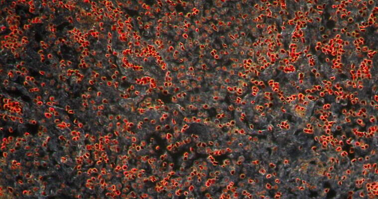 과학 이동 패턴 세포 사람없음 빨간색 파란색 약 시험 성장 조직 확대 에이즈 지원 4K 현미경관찰 MOV 해외동영상 클립영상 교육 컬러 컨셉 무늬 의학 관찰 질병 동영상 파일형식