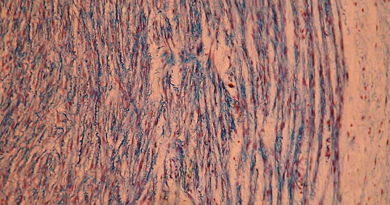 과학 이동 세포 사람없음 빨간색 파란색 약 시험 성장 조직 확대 지원 4K 현미경관찰 MOV 해외동영상 클립영상 교육 컬러 컨셉 의학 관찰 동영상 파일형식