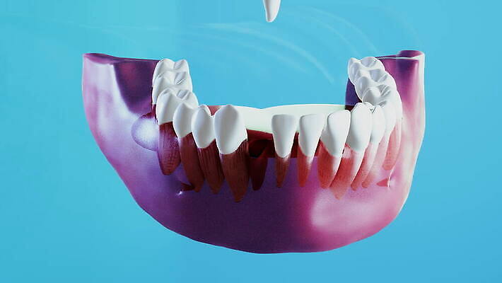 모델 과학 해부 왕관 건강 치과 사람 사람없음 치료 약 3D 흰색 도자기 입 치아 치과의사 만들기 뿌리 애니메이션 외과 턱 틀니 방법 보철 설치 위생관리 인공 잇몸 치아교정 치유 4K 구강학 MOV 해외동영상 클립영상 컬러 신체 의학 모션 병원 관리 신체부위 의사 소화기관 디지털합성 교정 동영상 파일형식