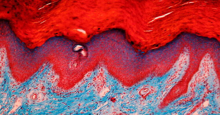 과학 이동 세포 사람없음 빨간색 파란색 약 시험 성장 조직 확대 쥐 피부 지원 4K 현미경관찰 MOV 해외동영상 클립영상 교육 컬러 컨셉 의학 신체부위 관찰 설치류 동영상 파일형식