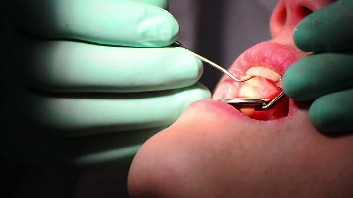 백인 직업 여자 산업 어린이 건강 치과 병원 사람 치료 약 장비 환자 의사 기구 오픈 입 닫기 치아 무서움 부식 치과의사 방문 순서 돌봄 명패 송곳 위생관리 잇몸 HD 구강학 MOV 해외동영상 클립영상 서양인 감정 신체 의학 모션 관리 신체부위 의료진 소화기관 동영상 파일형식