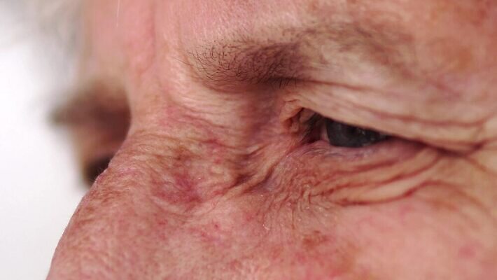 백인 응시 여자 할머니 얼굴 엄마 건강 피곤 사람 성인 아웃포커스 슬픔 흰색 주름 닫기 울음 피부 눈물 외과 돌봄 옛날 우울증 혼자 노화 광학 4K MP4 해외동영상 클립영상 서양인 시선 노년 감정 컬러 컨셉 의학 가족 모션 촬영기법 표정 병원 신체부위 질병 동영상 파일형식