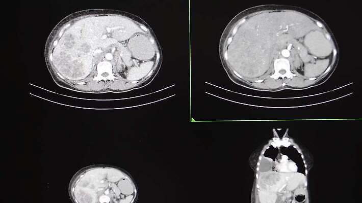 과학 이동 신체 모션 엑스레이 사람 사람없음 내부 컴퓨터 검은색 시험 광선 하트 구멍 오르간 허파 고급 X 척추 간 몸통 덩어리 궤 스캔 종양 4K MP4 해외동영상 클립영상 모양 알파벳 교육 컬러 컨셉 의학 뼈 신체부위 전자제품 장기_의학 건반악기 호흡기관 동영상 파일형식