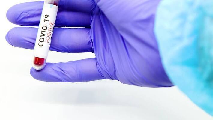 유럽 과학 실험 치료 라벨 견본 건강관리 미국 장비 의사 실험실 바이러스 결과 질병 컨테이너 수집 분석 시험관 긍정 전염 유럽연합 전염병 사스 코로나바이러스 4K 유체 MP4 해외동영상 클립영상 나라 산업 컨셉 북아메리카 의학 프레임 건강 실험기구 관리 의료진 감염 동영상 파일형식