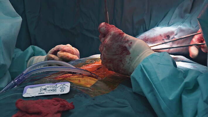 패턴 신체 건강 병원 사람 치료 약 고통 장비 환자 의사 심장 긴급 조직 혈액 수술 질병 상처 위험 자르기 피부 땀 튜브 외과 배수구 삭제 궤 돌봄 위생관리 절개 치유 흉터 4K MOV 해외동영상 클립영상 감정 컨셉 무늬 의학 모션 관리 신체부위 의료진 장기_의학 동영상 파일형식