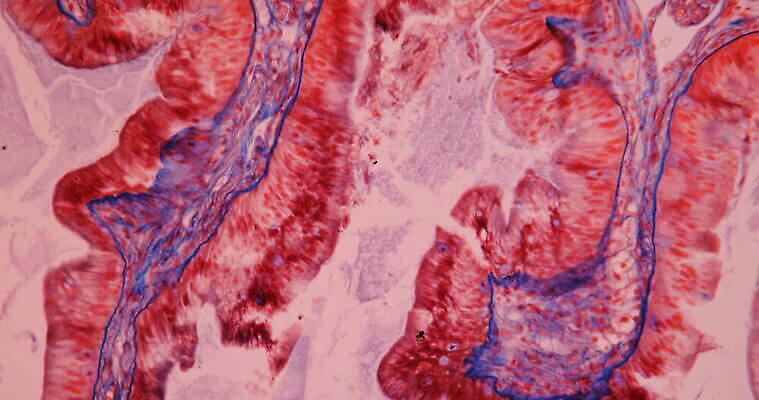 과학 이동 세포 사람없음 빨간색 약 시험 성장 조직 확대 쥐 부드러움 췌장 지원 4K 현미경관찰 MOV 해외동영상 클립영상 교육 컬러 컨셉 의학 관찰 장기_의학 감각 설치류 동영상 파일형식