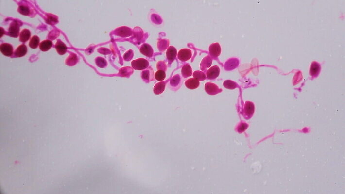 식물 동물 디자인 꽃잎 분홍색 과학 백그라운드 패턴 해부 추상 세포 건강 현미경 실험 미술 사람없음 그래픽 약 페인트 활발 점 조직 오르간 실험실 확대 백합 묘사 유기농 질감 생물학 시스템 그런지 꽃수술 MOV 해외동영상 클립영상 웰빙 교육 꽃 컬러 컨셉 무늬 의학 문화예술 실험기구 건반악기 동영상 파일형식
