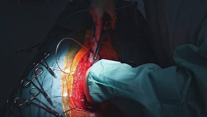 패턴 신체 건강 병원 사람 사람없음 치료 약 고통 장비 환자 의사 심장 긴급 조직 혈액 수술 질병 상처 위험 자르기 피부 땀 튜브 외과 배수구 삭제 궤 돌봄 위생관리 절개 치유 흉터 4K MOV 해외동영상 클립영상 감정 컨셉 무늬 의학 모션 관리 신체부위 의료진 장기_의학 동영상 파일형식