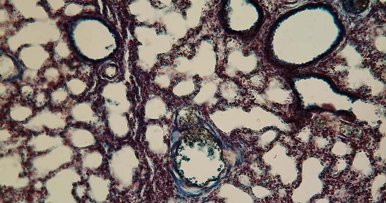 과학 이동 세포 사람없음 빨간색 파란색 약 시험 성장 조직 확대 쥐 지원 4K 현미경관찰 MOV 해외동영상 클립영상 교육 컬러 컨셉 의학 관찰 설치류 동영상 파일형식