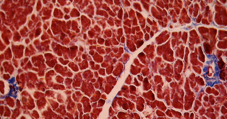 과학 이동 세포 사람없음 빨간색 약 시험 성장 조직 확대 쥐 부드러움 췌장 지원 4K 현미경관찰 MOV 해외동영상 클립영상 교육 컬러 컨셉 의학 관찰 장기_의학 감각 설치류 동영상 파일형식