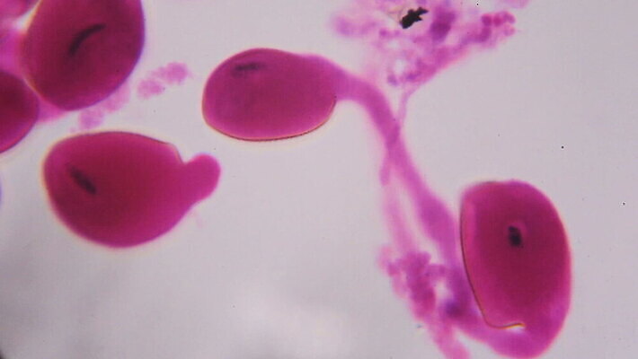 식물 동물 디자인 꽃잎 분홍색 과학 백그라운드 패턴 해부 추상 세포 건강 현미경 실험 미술 사람없음 그래픽 약 페인트 활발 점 조직 오르간 실험실 확대 백합 묘사 유기농 질감 생물학 시스템 그런지 꽃수술 MOV 해외동영상 클립영상 웰빙 교육 꽃 컬러 컨셉 무늬 의학 문화예술 실험기구 건반악기 동영상 파일형식