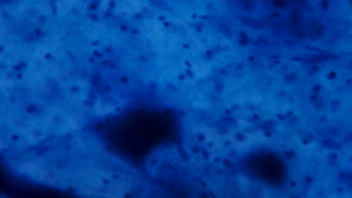 동물 디자인 과학 백그라운드 패턴 부분 해부 추상 세포 건강 현미경 실험 미술 사람없음 그래픽 파란색 약 페인트 점 조직 오르간 실험실 확대 불안 뇌 유기농 질감 생물학 시스템 그런지 MOV 해외동영상 클립영상 웰빙 교육 감정 컬러 무늬 의학 문화예술 실험기구 건반악기 동영상 파일형식