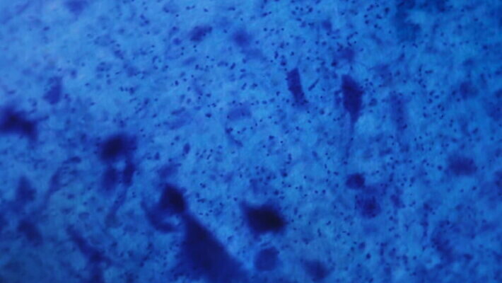 동물 디자인 과학 백그라운드 패턴 부분 해부 추상 세포 건강 현미경 실험 미술 사람없음 그래픽 파란색 약 페인트 점 조직 오르간 실험실 확대 불안 뇌 유기농 질감 생물학 시스템 그런지 MOV 해외동영상 클립영상 웰빙 교육 감정 컬러 무늬 의학 문화예술 실험기구 건반악기 동영상 파일형식