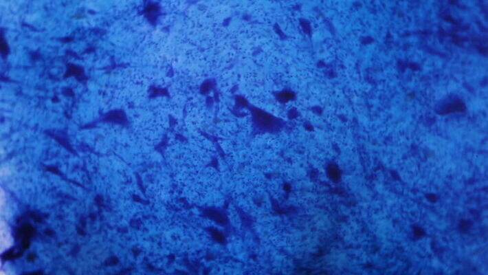 동물 디자인 과학 백그라운드 패턴 부분 해부 추상 세포 건강 현미경 실험 미술 사람없음 그래픽 파란색 약 페인트 점 조직 오르간 실험실 확대 불안 뇌 유기농 질감 생물학 시스템 그런지 MOV 해외동영상 클립영상 웰빙 교육 감정 컬러 무늬 의학 문화예술 실험기구 건반악기 동영상 파일형식