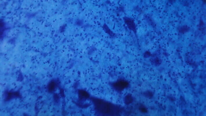 동물 디자인 과학 백그라운드 패턴 부분 해부 추상 세포 건강 현미경 실험 미술 사람없음 그래픽 파란색 약 페인트 점 조직 오르간 실험실 확대 불안 뇌 유기농 질감 생물학 시스템 그런지 MOV 해외동영상 클립영상 웰빙 교육 감정 컬러 무늬 의학 문화예술 실험기구 건반악기 동영상 파일형식