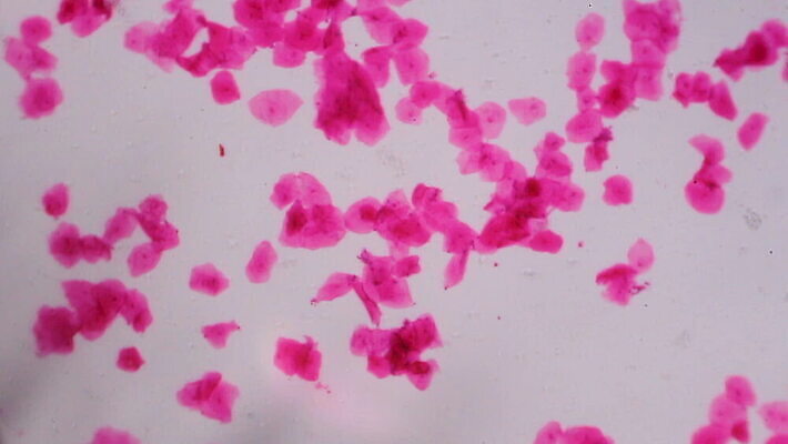 디자인 과학 백그라운드 패턴 해부 표면 추상 생물 세포 건강 현미경 미술 사람 사람없음 그래픽 약 보라색 페인트 입 조직 그룹 혈액 실험실 피부 질감 생물학 시스템 암 그런지 종양 MOV 해외동영상 클립영상 교육 컬러 무늬 의학 문화예술 실험기구 실험 신체부위 질병 동영상 파일형식