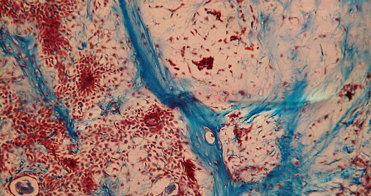 과학 이동 세포 사람없음 빨간색 파란색 약 시험 성장 조직 확대 질병 종양 지원 4K 현미경관찰 MOV 해외동영상 클립영상 교육 컬러 컨셉 의학 관찰 동영상 파일형식