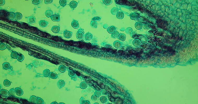 식물 꽃 과학 이동 세포 사람없음 빨간색 초록색 파란색 시험 성장 체리 조직 확대 떠남 지원 4K 현미경관찰 MOV 해외동영상 클립영상 교육 컬러 컨셉 과일 모션 관찰 동영상 파일형식