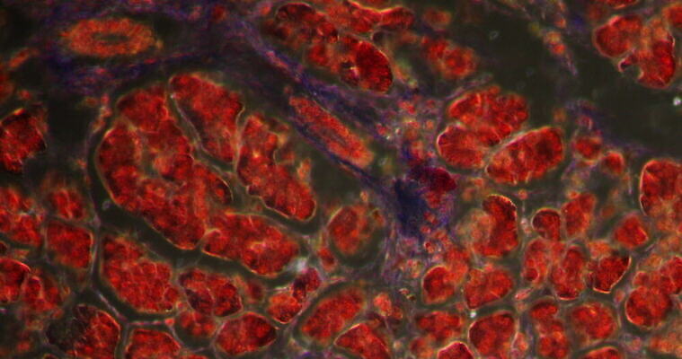 과학 이동 세포 사람없음 빨간색 약 시험 성장 조직 확대 췌장 인슐린 지원 4K 현미경관찰 MOV 해외동영상 클립영상 교육 컬러 컨셉 의학 관찰 장기_의학 동영상 파일형식