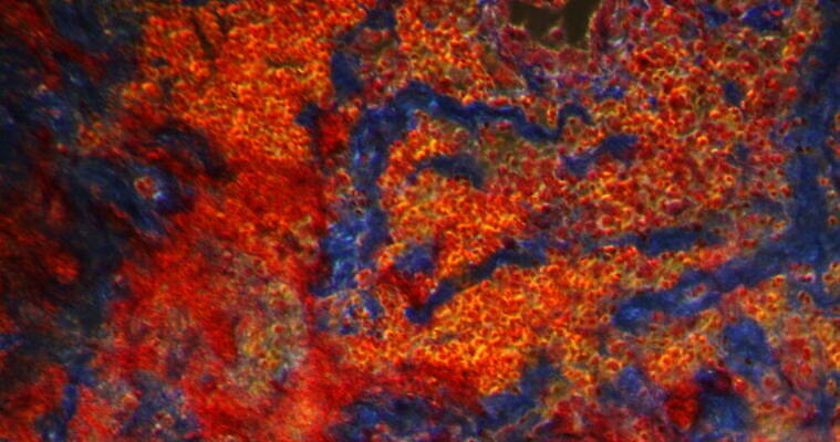 과학 패턴 세포 사람없음 빨간색 파란색 시험 성장 조직 질병 지원 4K 현미경관찰 MOV 해외동영상 클립영상 교육 컬러 무늬 의학 관찰 동영상 파일형식