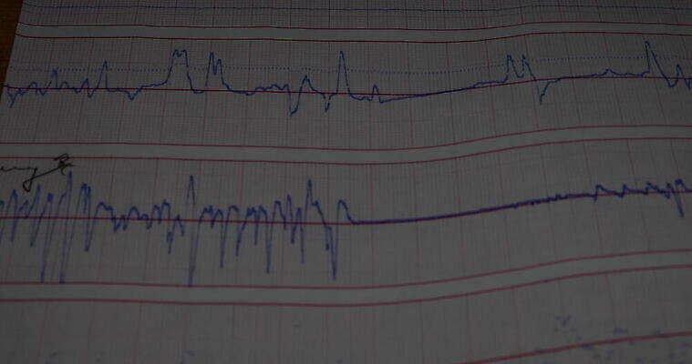 직업 과학 사람없음 약 의사 기록 종업원 분석 보고서 예방 서류판 적외선 화학자 4K MOV 해외동영상 클립영상 컨셉 의학 사무용품 의료진 과학자 동영상 파일형식