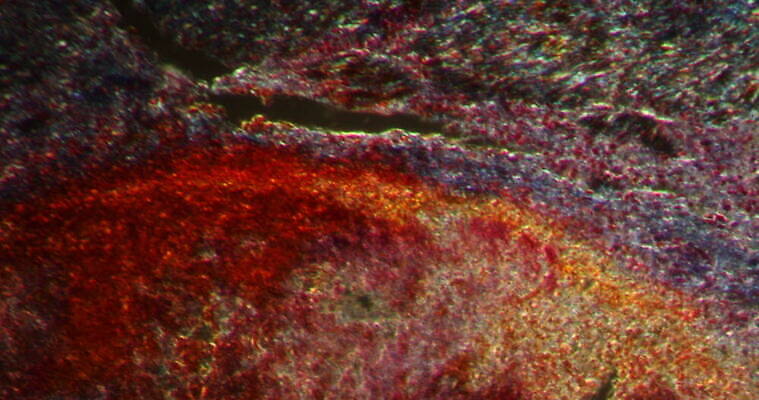 과학 이동 패턴 근육 세포 사람없음 빨간색 파란색 약 시험 성장 조직 확대 질병 염증 지원 4K 현미경관찰 MOV 해외동영상 클립영상 교육 컬러 컨셉 무늬 의학 관찰 동영상 파일형식