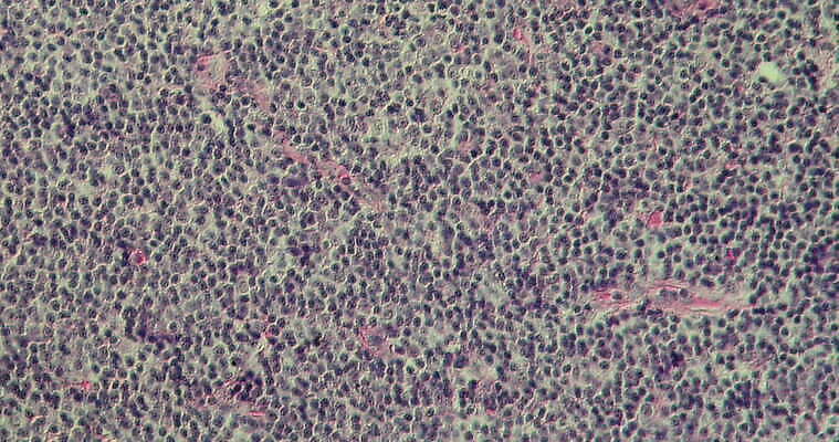 과학 이동 패턴 세포 사람없음 빨간색 파란색 약 시험 성장 조직 확대 질병 지원 4K 현미경관찰 MOV 해외동영상 클립영상 교육 컬러 컨셉 무늬 의학 관찰 동영상 파일형식