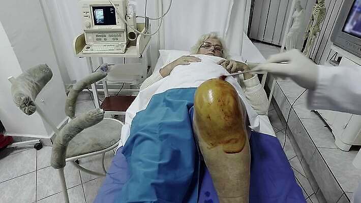 직업 장갑 건강 병원 주사기 한명 사람 약 방 고통 장비 환자 간호사 기구 공구 긴급 수술 극장 무릎 열쇠구멍 주사약 외과 순서 돌봄 작동 절개 정형외과 살균 4K MP4 해외동영상 클립영상 1 잡화 감정 의학 의료기기 모션 신체부위 치료 의료진 도구 동영상 파일형식