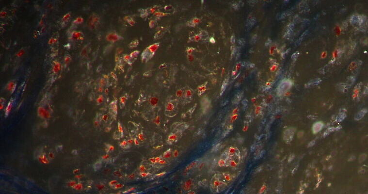 과학 이동 패턴 세포 사람없음 빨간색 파란색 약 시험 성장 조직 확대 지원 4K 현미경관찰 MOV 해외동영상 클립영상 교육 컬러 컨셉 무늬 의학 관찰 동영상 파일형식