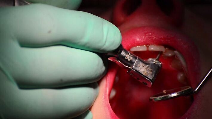 백인 직업 여자 산업 어린이 건강 치과 병원 사람 치료 약 장비 환자 의사 기구 오픈 입 닫기 치아 무서움 부식 치과의사 방문 순서 돌봄 명패 송곳 위생관리 잇몸 HD 구강학 MOV 해외동영상 클립영상 서양인 감정 신체 의학 모션 관리 신체부위 의료진 소화기관 동영상 파일형식