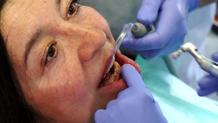 백인 직업 응시 여자 장갑 건강 치과 병원 한명 성인 치료 약 장비 환자 의사 기구 도구 붓 오픈 입 닫기 치아 계획 치과의사 예방 뿌리 광택 닦기 외과 턱 틀니 순서 돌봄 명패 위생관리 제어 치유 4K MOV 해외동영상 클립영상 서양인 1 시선 잡화 컨셉 의학 모션 관리 사람 신체부위 의료진 소화기관 동영상 파일형식