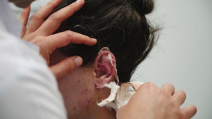 손 장갑 부분 손가락 병원 약 간호사 의사 덮개 기구 공구 대접 잡기 악단 수술 당기기 플라스틱 자르기 하락 피부 묘사 귀 붕대 테이프 외과 테라피 삭제 석고 솜씨 연골 운영자 4K MP4 해외동영상 클립영상 잡화 음악 컨셉 의학 모션 재질 문구용품 신체부위 치료 뷰티 의료진 뚜껑 도구 동영상 파일형식