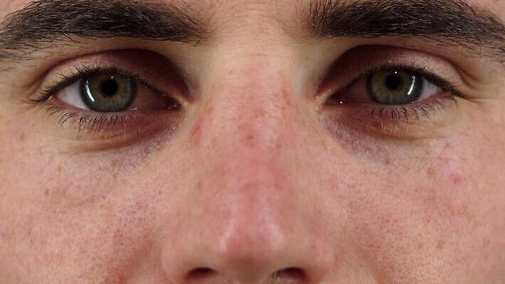 학생 웰빙 응시 남자 여유 얼굴 성공 아이디어 한명 사람 초록색 뷰티 평화 화목 꿈 오픈 자신감 닫기 눈썹 집중 시력 긍정 비전 안과 리빙 내추럴 배려 심각 지능 몽환 카피스페이스 표현성 4K MOV 해외동영상 클립영상 1 시선 감정 컬러 컨셉 모션 병원 신체부위 공백 동영상 파일형식