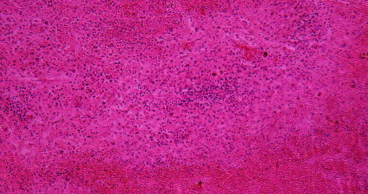 과학 이동 패턴 세포 사람없음 빨간색 파란색 약 시험 성장 조직 확대 질병 암 종양 지원 4K 현미경관찰 MOV 해외동영상 클립영상 교육 컬러 컨셉 무늬 의학 관찰 동영상 파일형식